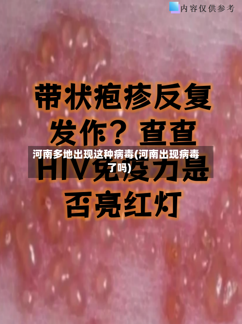 河南多地出现这种病毒(河南出现病毒了吗)