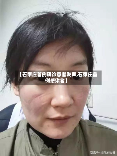 【石家庄首例确诊患者发声,石家庄首例感染者】-第3张图片