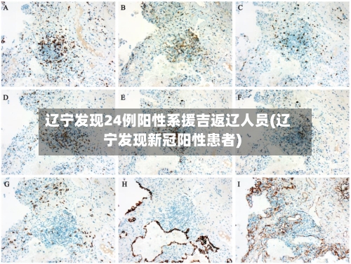 辽宁发现24例阳性系援吉返辽人员(辽宁发现新冠阳性患者)-第2张图片