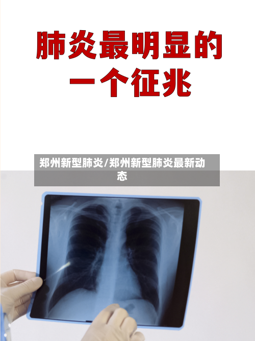 郑州新型肺炎/郑州新型肺炎最新动态