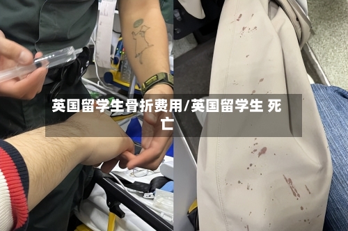 英国留学生骨折费用/英国留学生 死亡