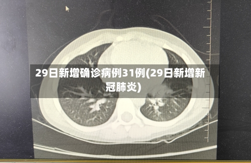29日新增确诊病例31例(29日新增新冠肺炎)