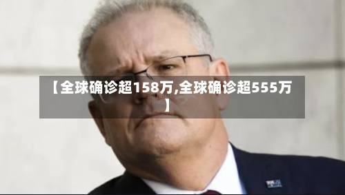 【全球确诊超158万,全球确诊超555万】-第2张图片