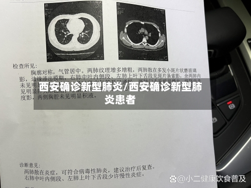 西安确诊新型肺炎/西安确诊新型肺炎患者