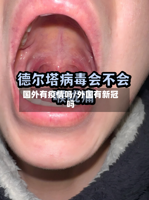 国外有疫情吗/外国有新冠吗-第2张图片